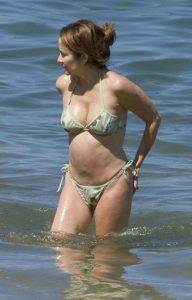 Patricia Heaton before and after her tummy tuck