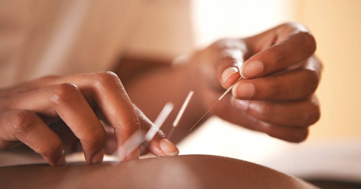 The benefits that can be achieved with acupuncture