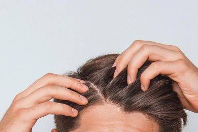 How to Treat Scabs on the Scalp