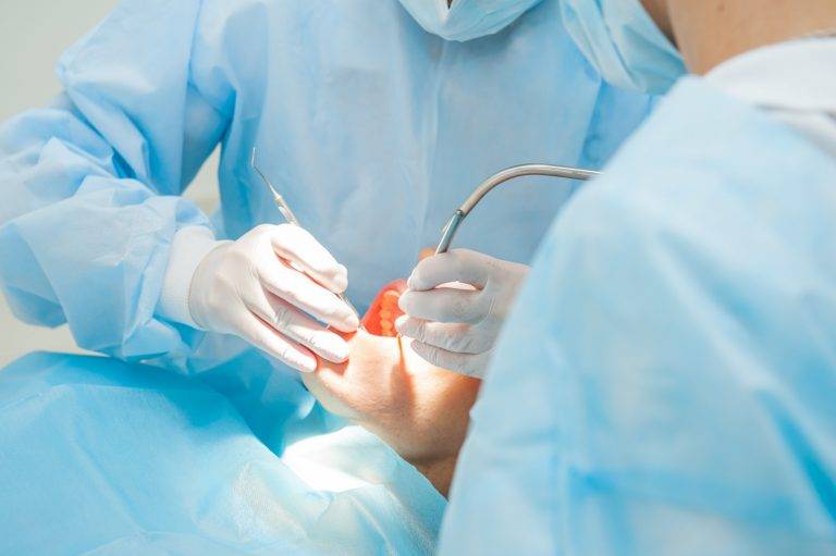 Oral Health: Dental Surgeries That Can Improve Your Smile