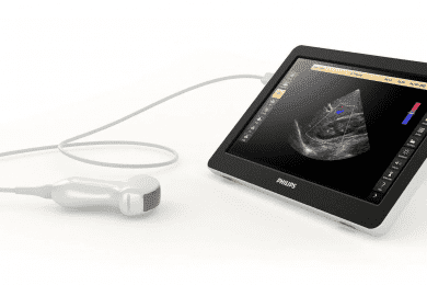 How to Choose the Best Refurbished Ultrasound Machine for You