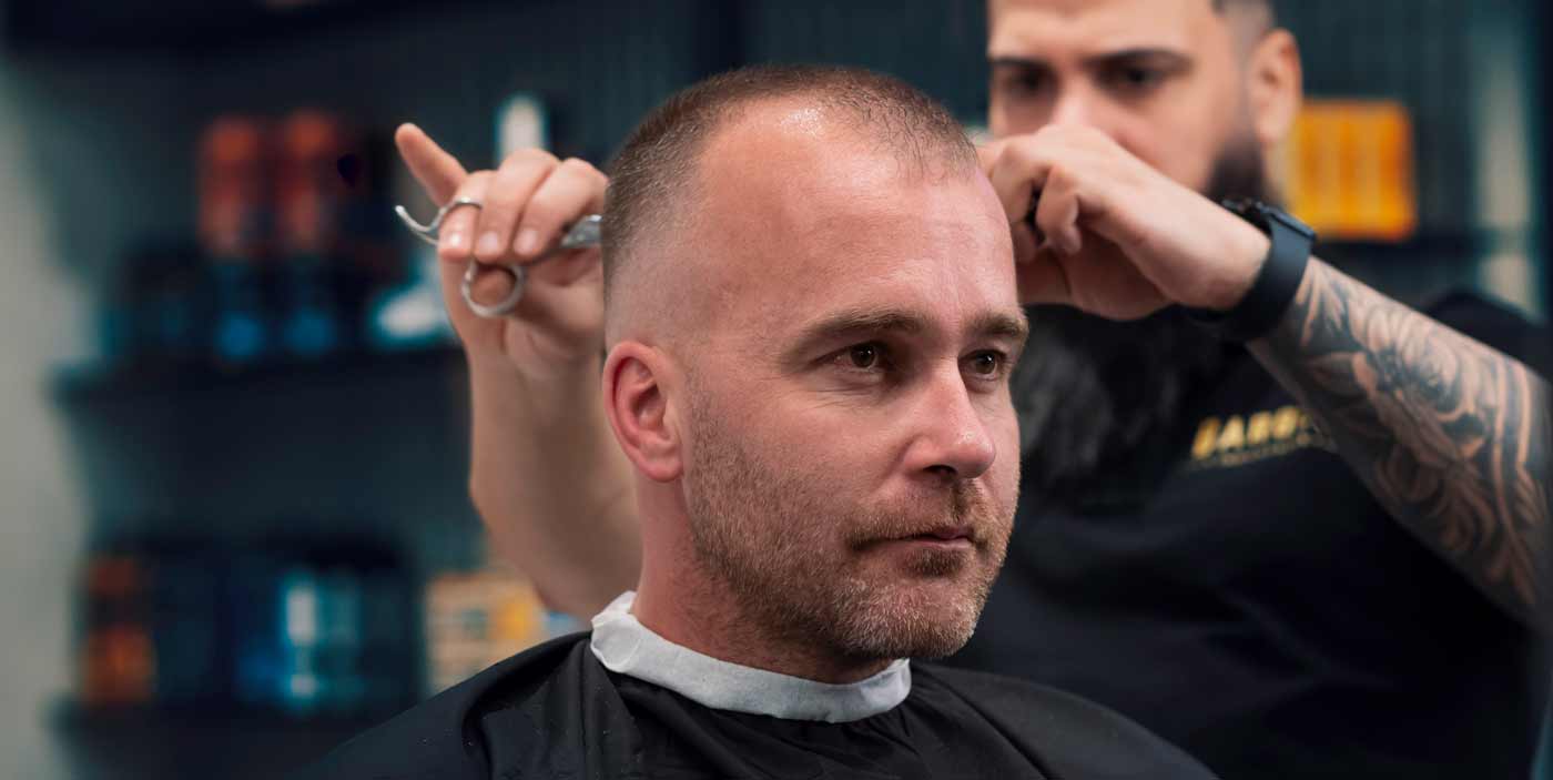 3 Ways to Improve Your Appearance Despite Balding